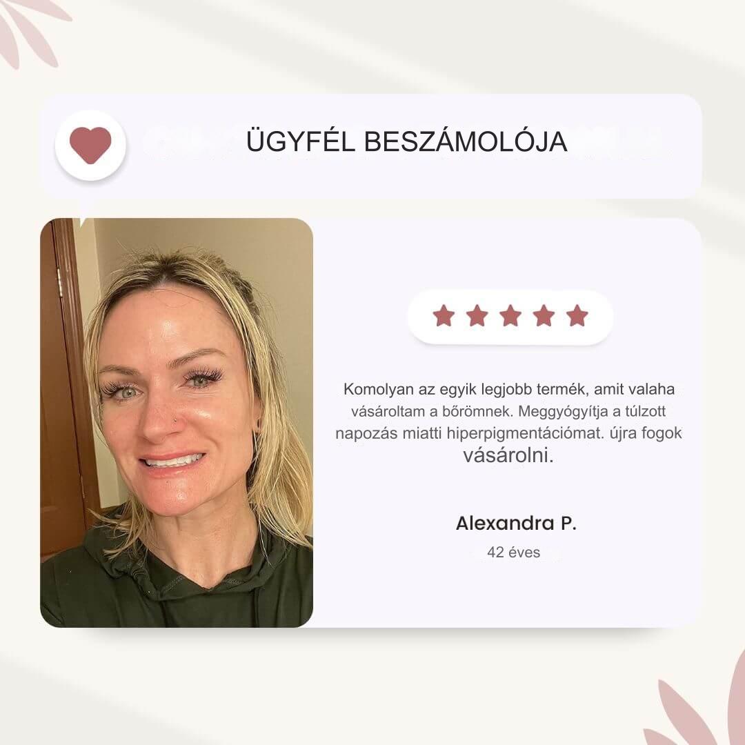 Bonatura+™️ Kurkuma arcszérum | Frissítse fel bőrét és szabaduljon meg végleg a sötét foltoktól!