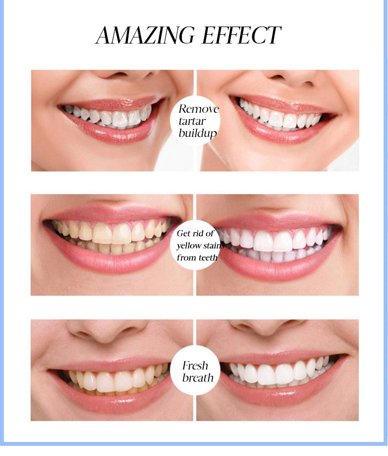 BrightSmilez™ Fogfehérítő toll
