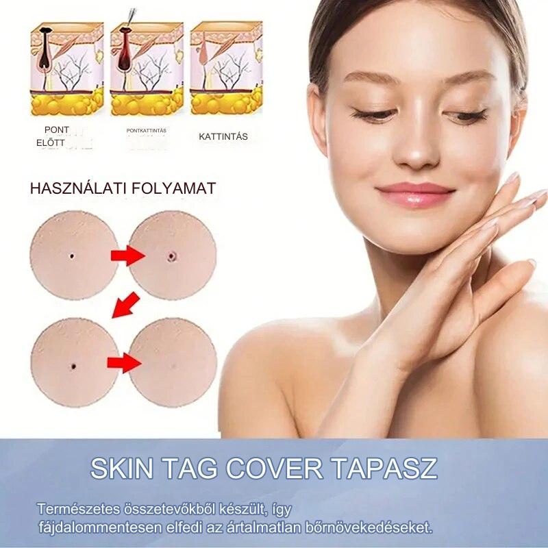 CoverLux™ Tapaszok a bőrfoltok és anyajegyek eltávolítására
