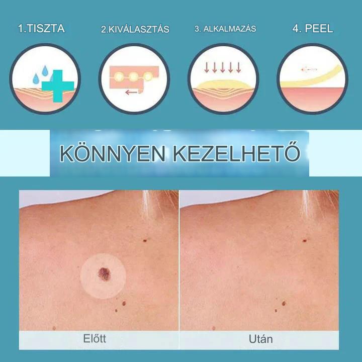 CoverLux™ Tapaszok a bőrfoltok és anyajegyek eltávolítására