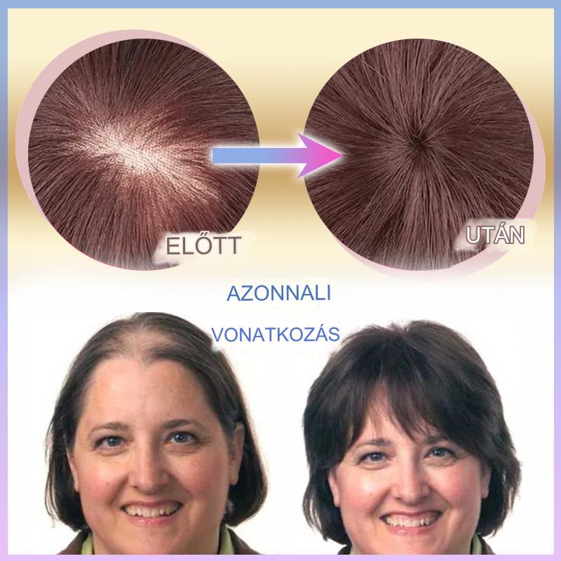 CrownLift™️ Finom rövid haj nőknek