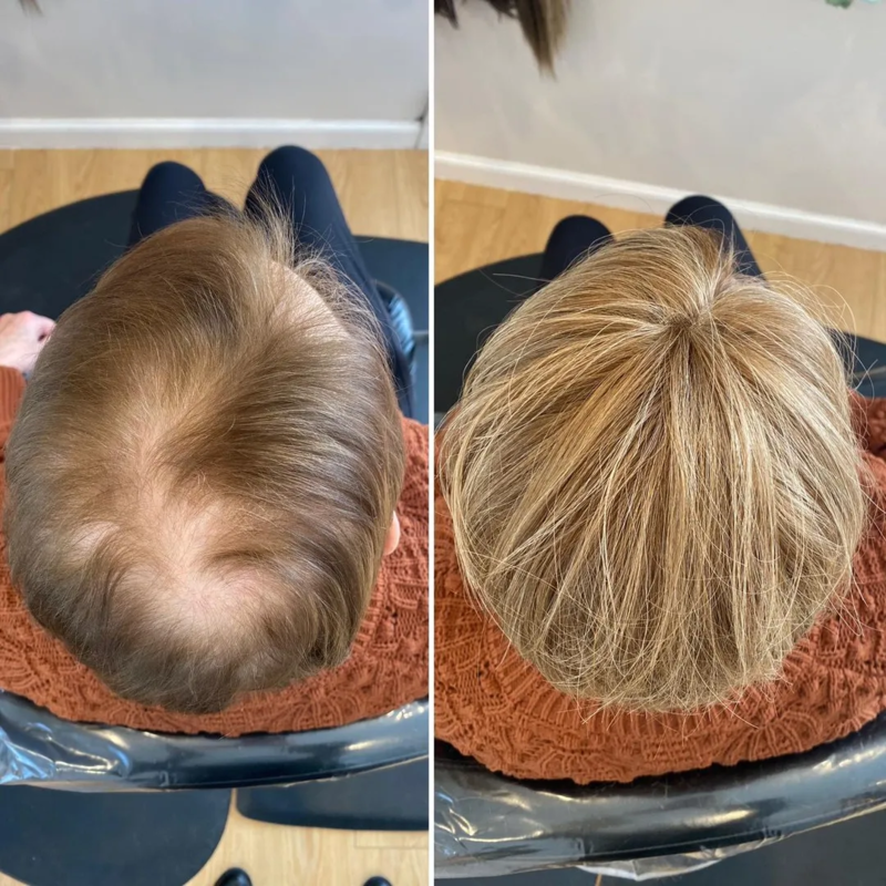 CrownLift™️ Finom rövid haj nőknek