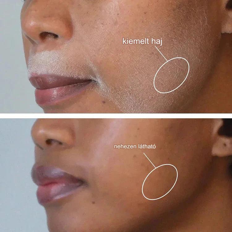 Derma Plane™ Bőrborotválkozó spray arcra és testre + INGYENES arcborotvák