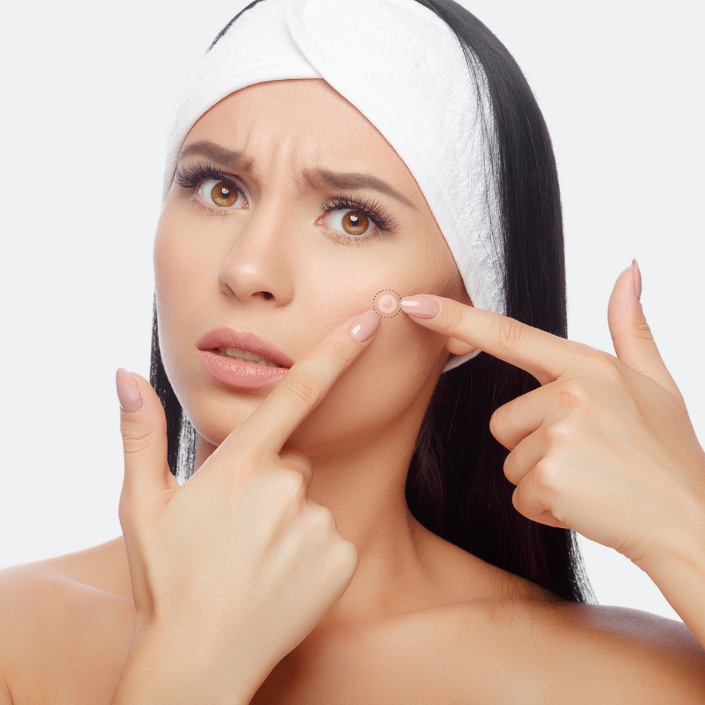 DermaReliv Pro+™️ Bőrfoltok eltávolítására szolgáló tapaszok