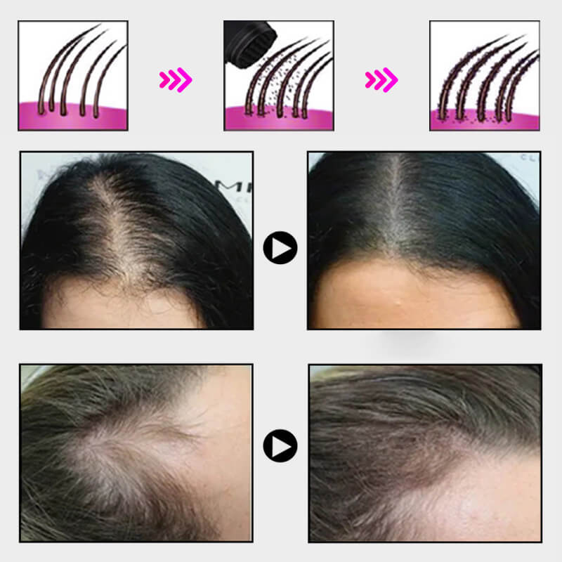 EELHOE HAIR™ Púder hajhullás ellen és a hajvonal gyors feltöltése