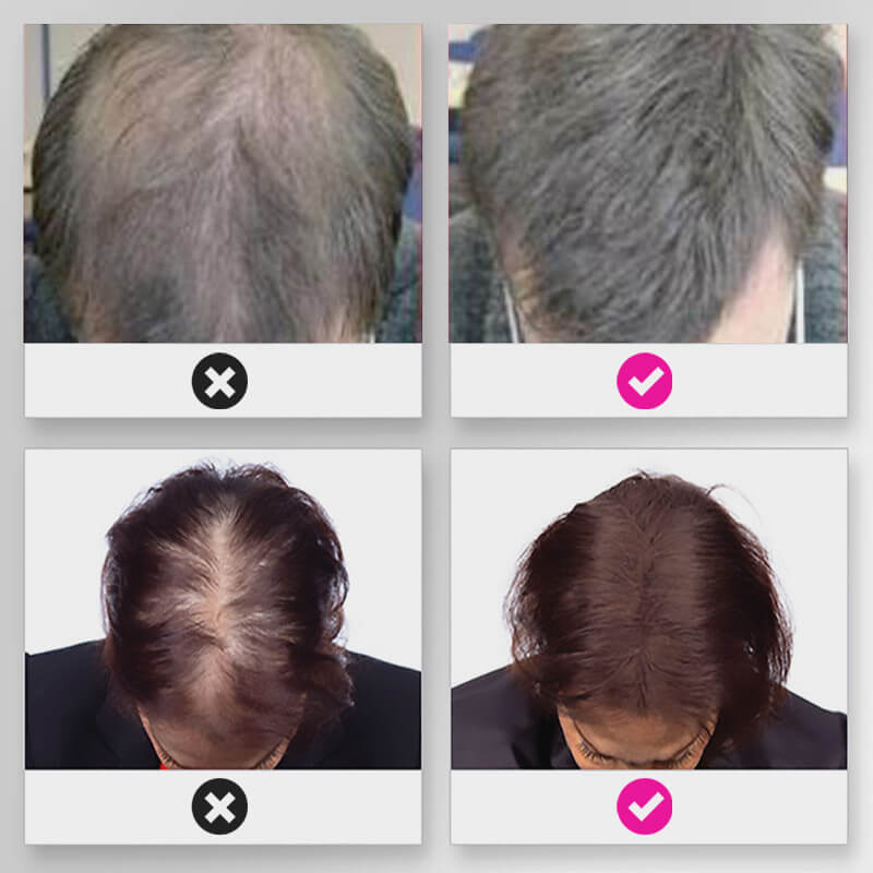 EELHOE HAIR™ Púder hajhullás ellen és a hajvonal gyors feltöltése