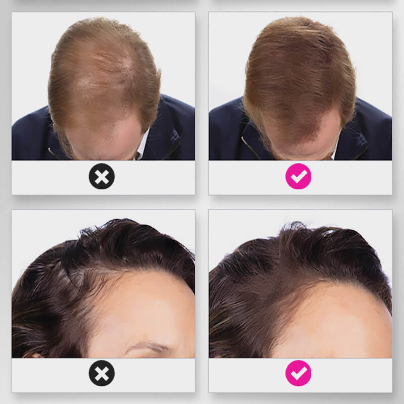 EELHOE HAIR™ Púder hajhullás ellen és a hajvonal gyors feltöltése