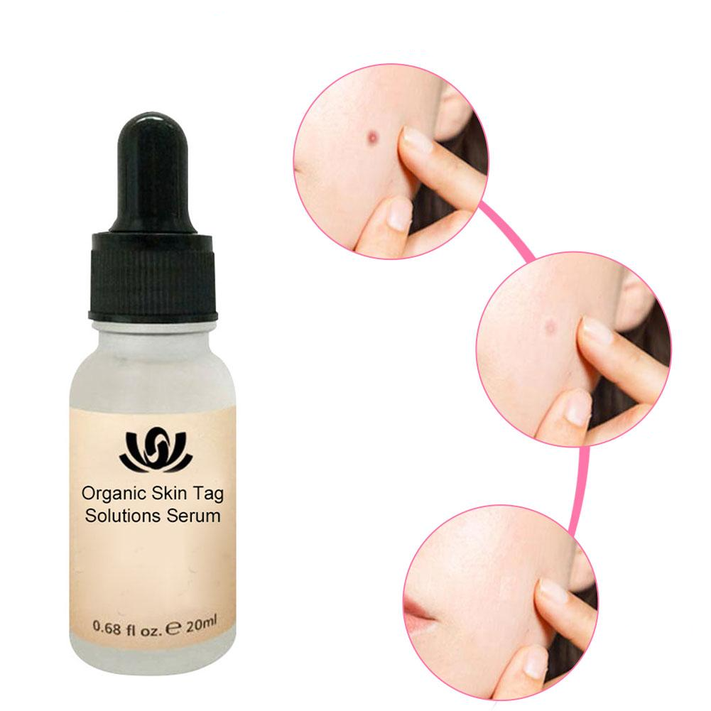HerbCare™ Organic Skin Blemish Serum | Véglegesen távolítsa el a bosszantó bőrfoltokat!