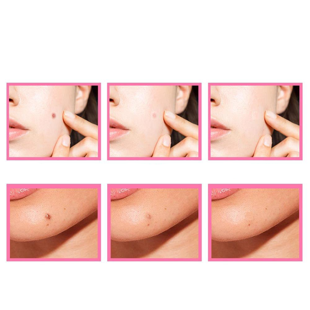 HerbCare™ Organic Skin Blemish Serum | Véglegesen távolítsa el a bosszantó bőrfoltokat!