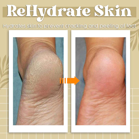 Herbcure+™ Gombaellenes spray | | Szabaduljon meg a kellemetlen gombáktól gyorsan és hatékonyan!