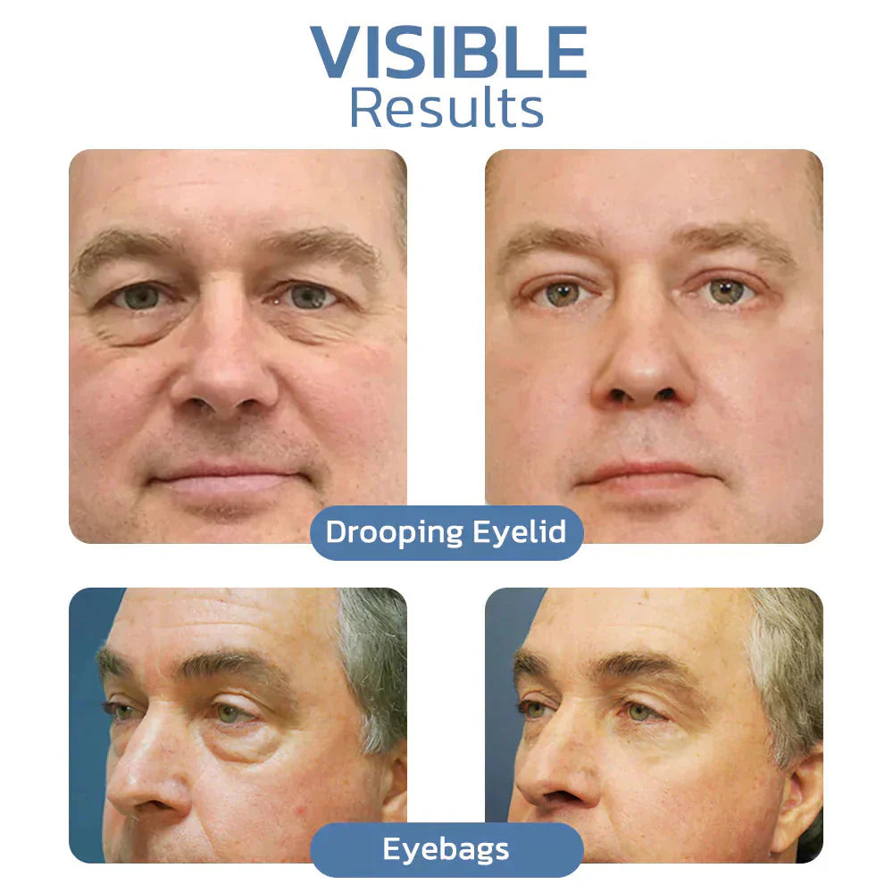 Himse OpenEyes™️ Peptid gél a szem körüli bőr megfiatalítására és felhúzására
