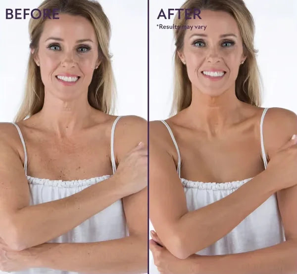 HydraTint™ Hidratáló concealer
