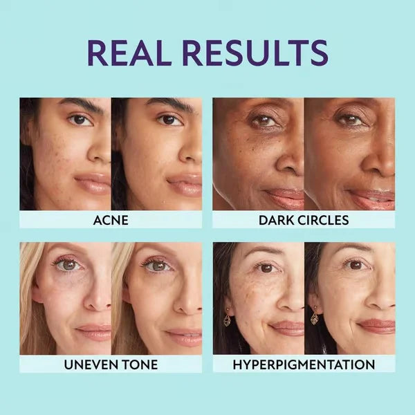 HydraTint™ Hidratáló concealer