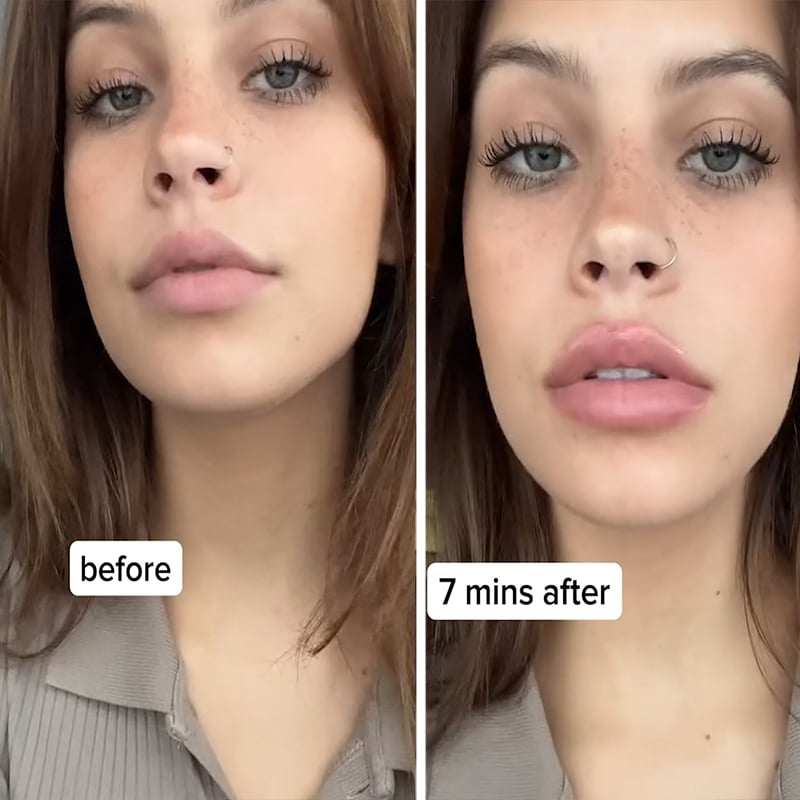 KissBeauty™ Azonnali ajakfeltöltő plumper