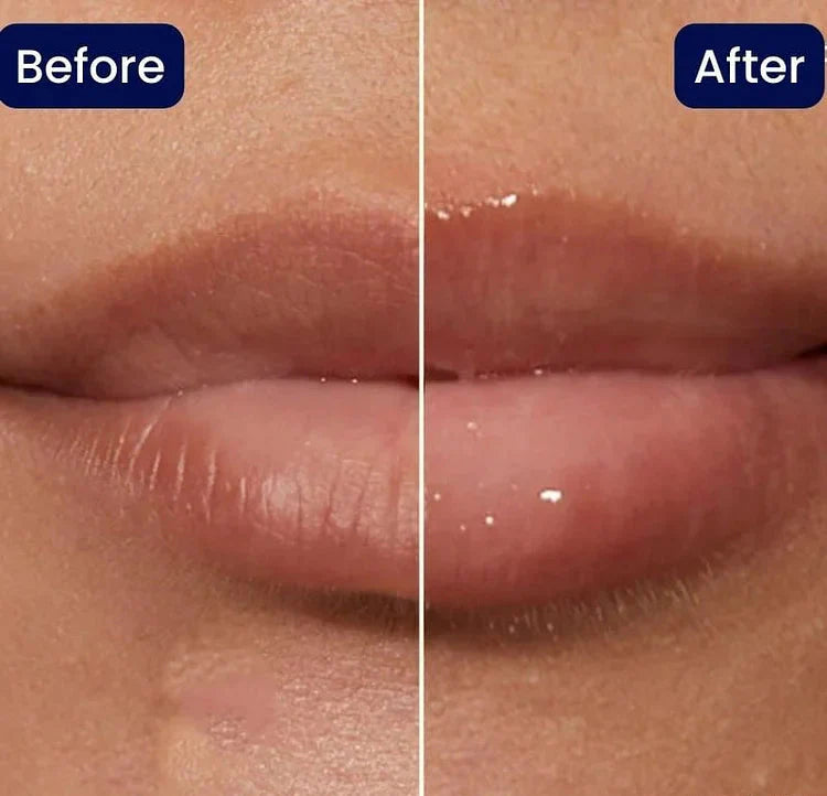 KissBeauty™ Azonnali ajakfeltöltő plumper