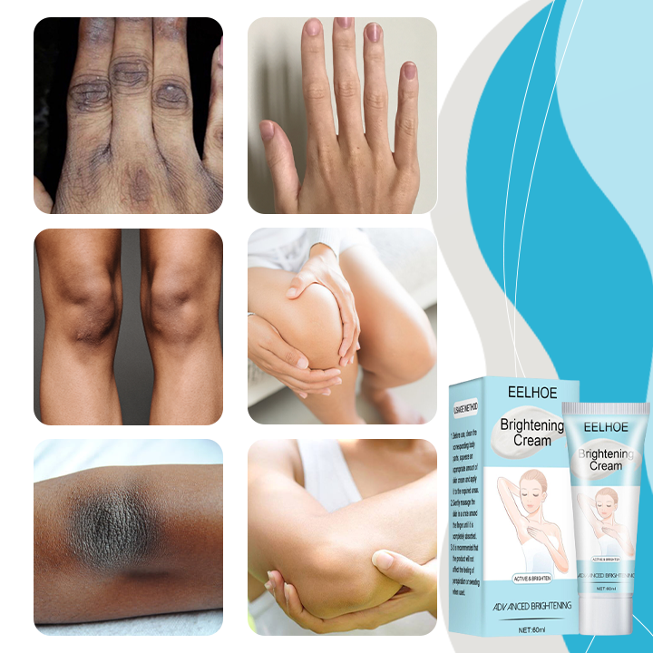 Luxfume™ Testfehérítő krém