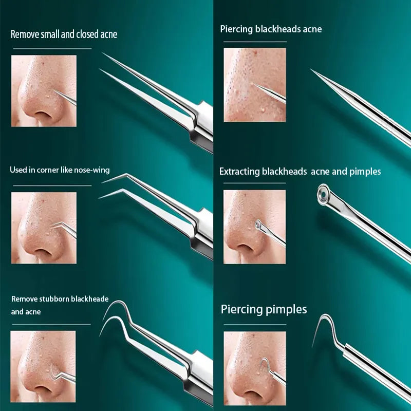 MrClean Set™ Mitesszer eltávolító készlet