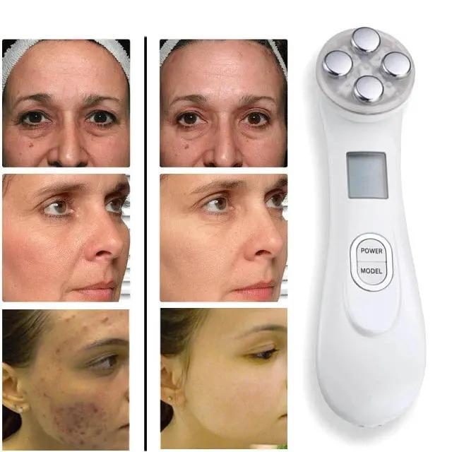 Revita Glow™ Masszírozó a bőr felhúzásához