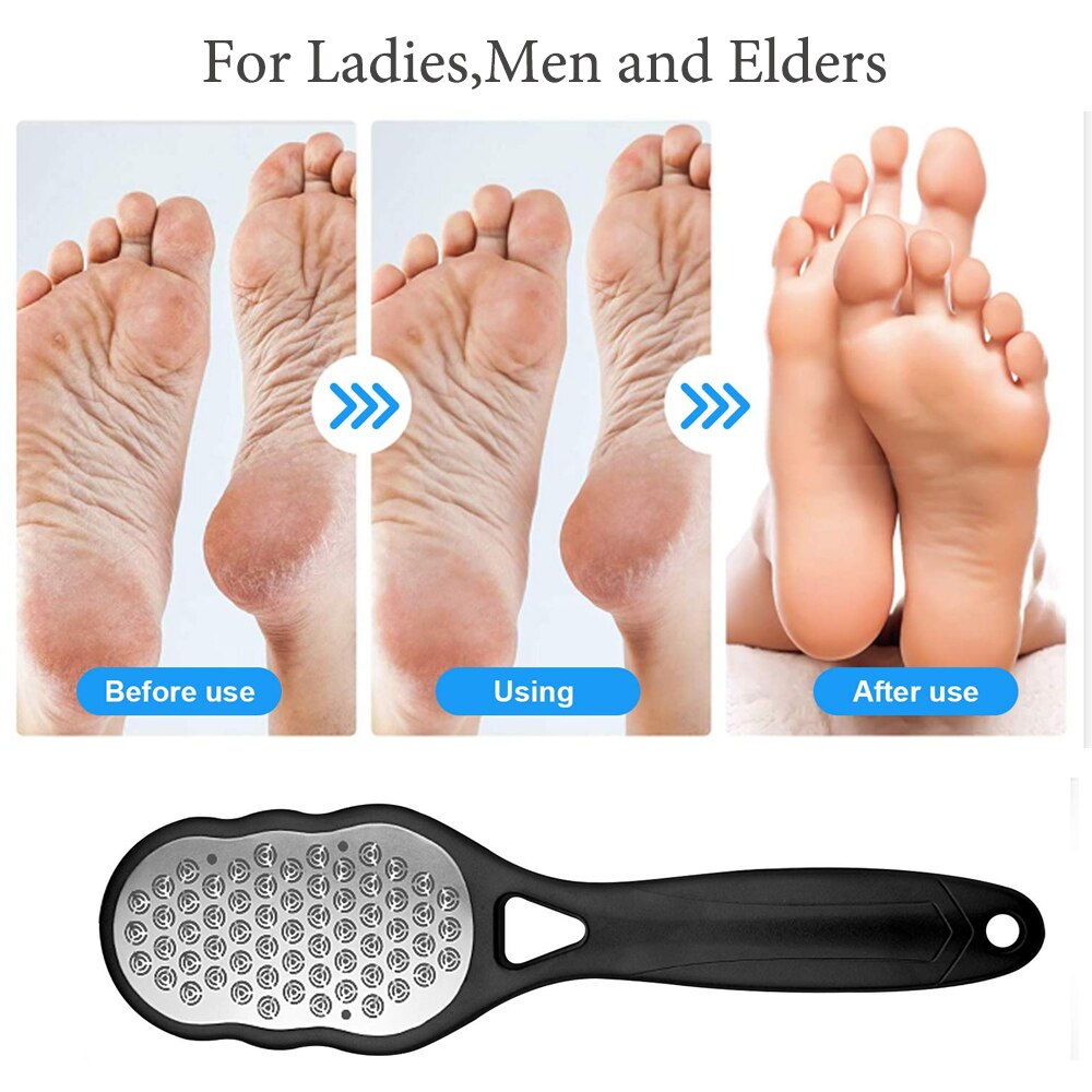ScrapeBuddy™️ Rozsdamentes acél bőrkeményedés borotva | Újjászületettnek és kiteljesedettnek érzed magad!