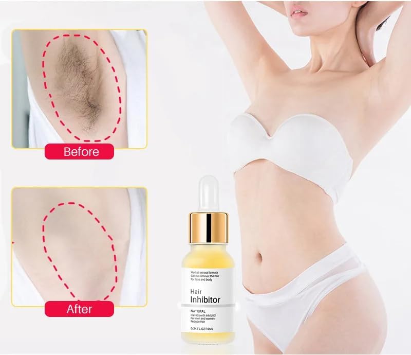 Seraphine™ Hibátlan testszőrtelenítés