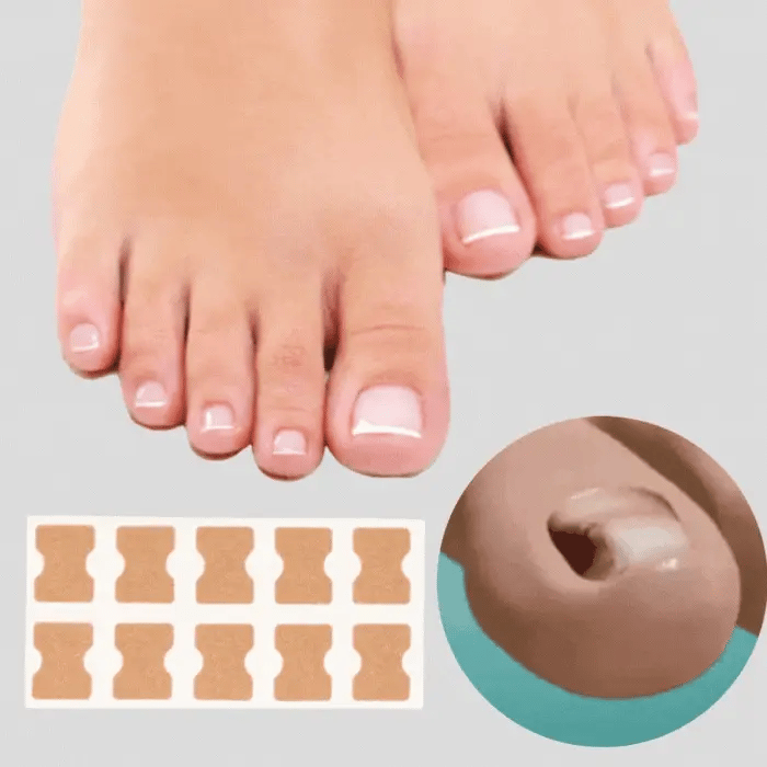ToeFix+ Körömtapaszok | Szabaduljon meg a benőtt körmöktől!
