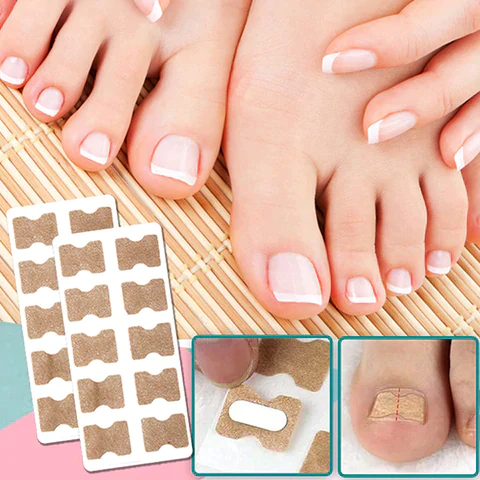 ToeFix+ Körömtapaszok | Szabaduljon meg a benőtt körmöktől!