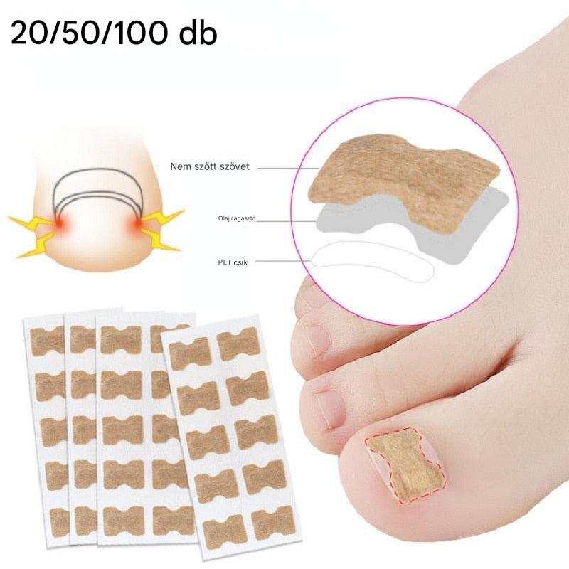 ToeFix+ Körömtapaszok | Szabaduljon meg a benőtt körmöktől!