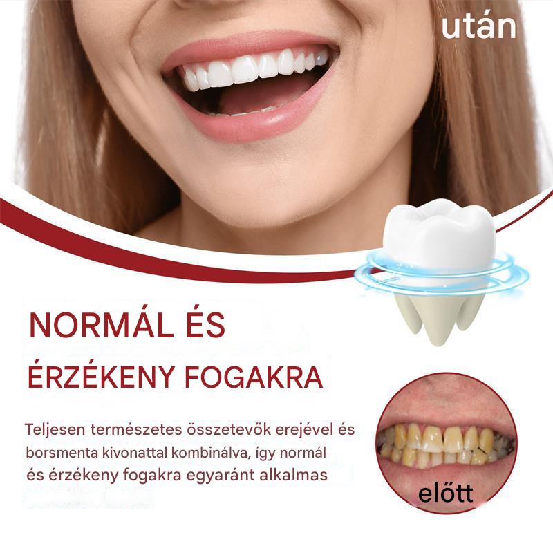 Vital Smile™ Super Probiotic-6 fogkrém 6 probiotikummal