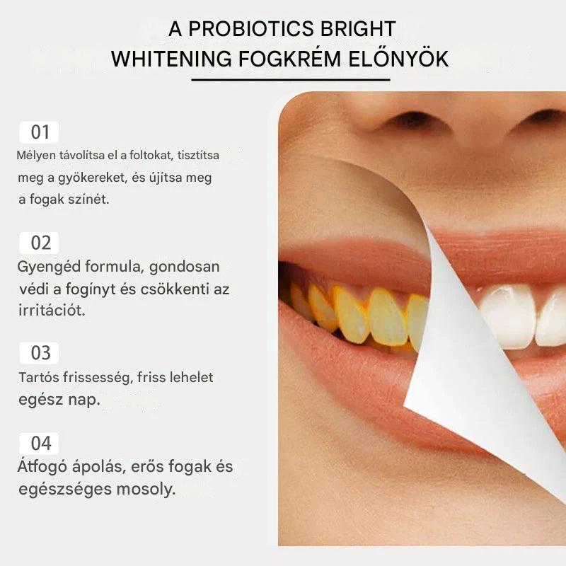 Vital Smile™ Super Probiotic-6 fogkrém 6 probiotikummal