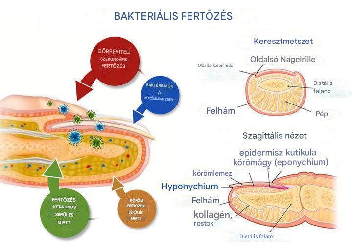 ClearZap™ Berendezés formák lézeres kezeléséhez